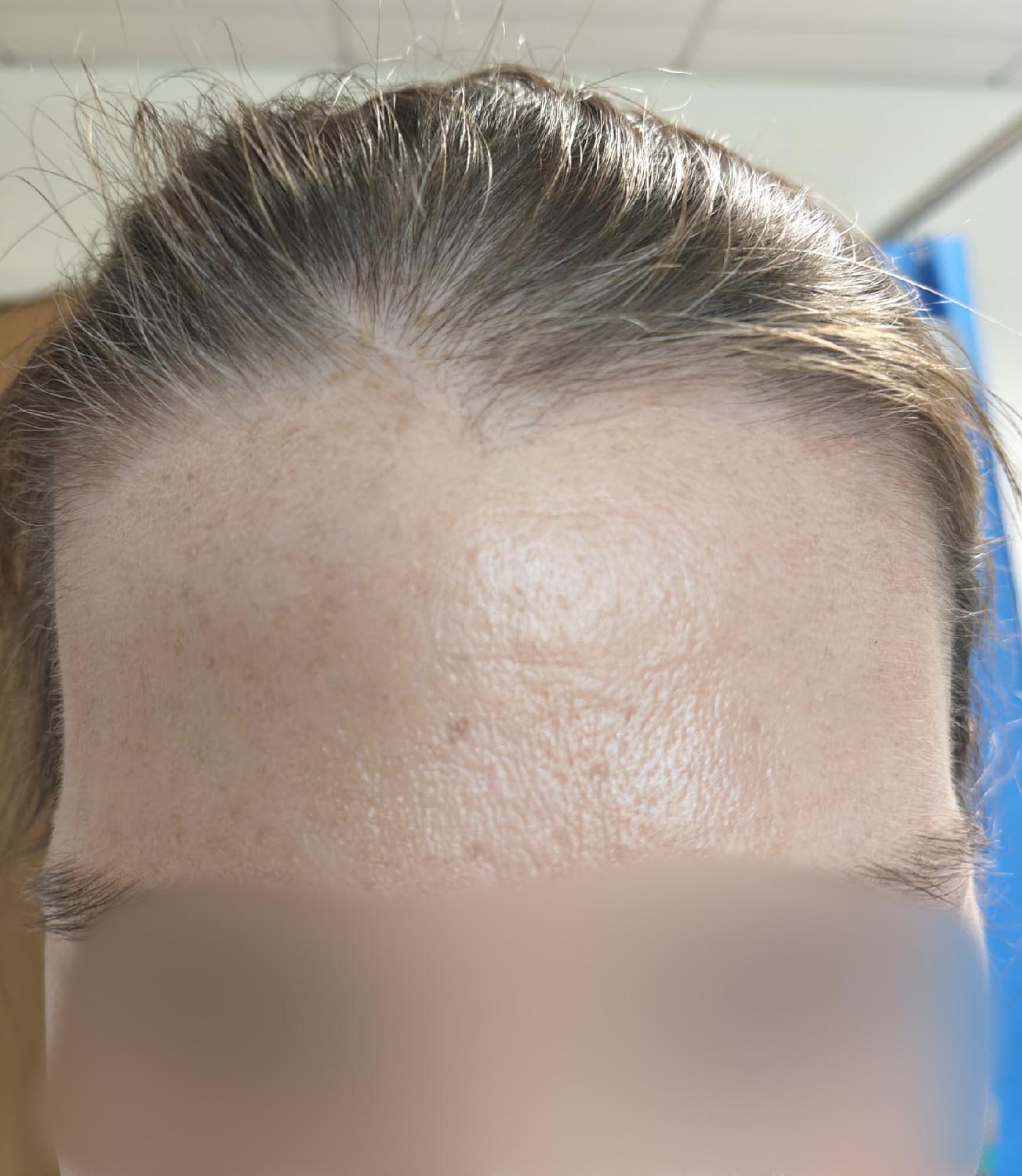 After image