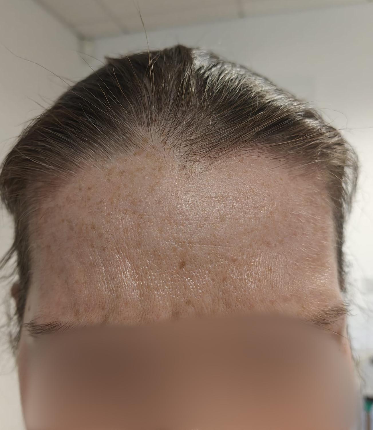 Before image