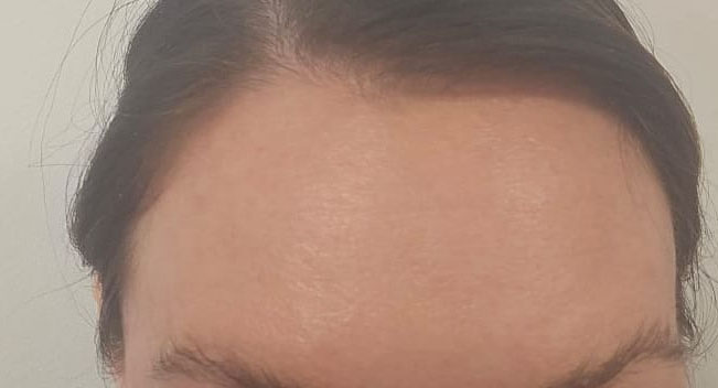 After image