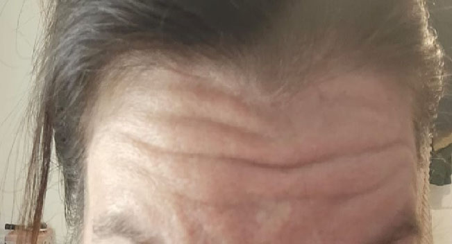 Before image