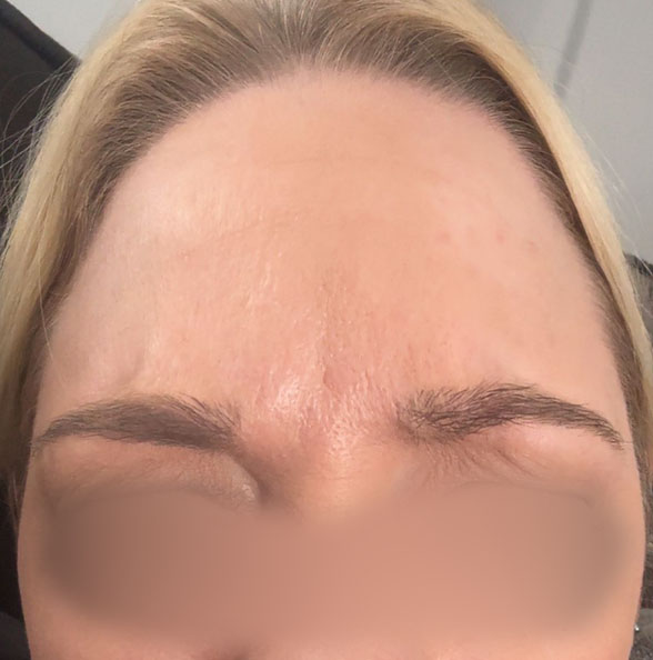 After image